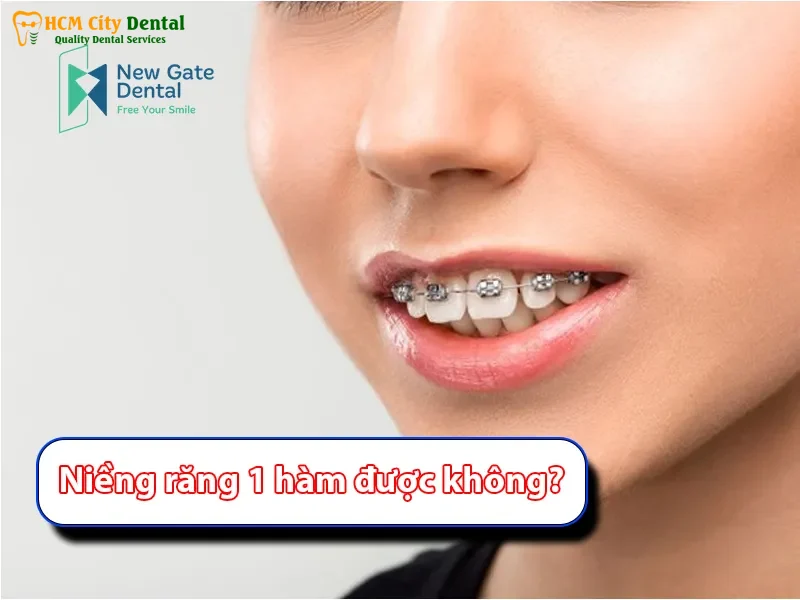 Nieng-rang-bao-nhieu-tien-1-ham-4-bac-si-cuong-nha-khoa-bscuong-bac-si-cuong-nha-khoa-bscuong