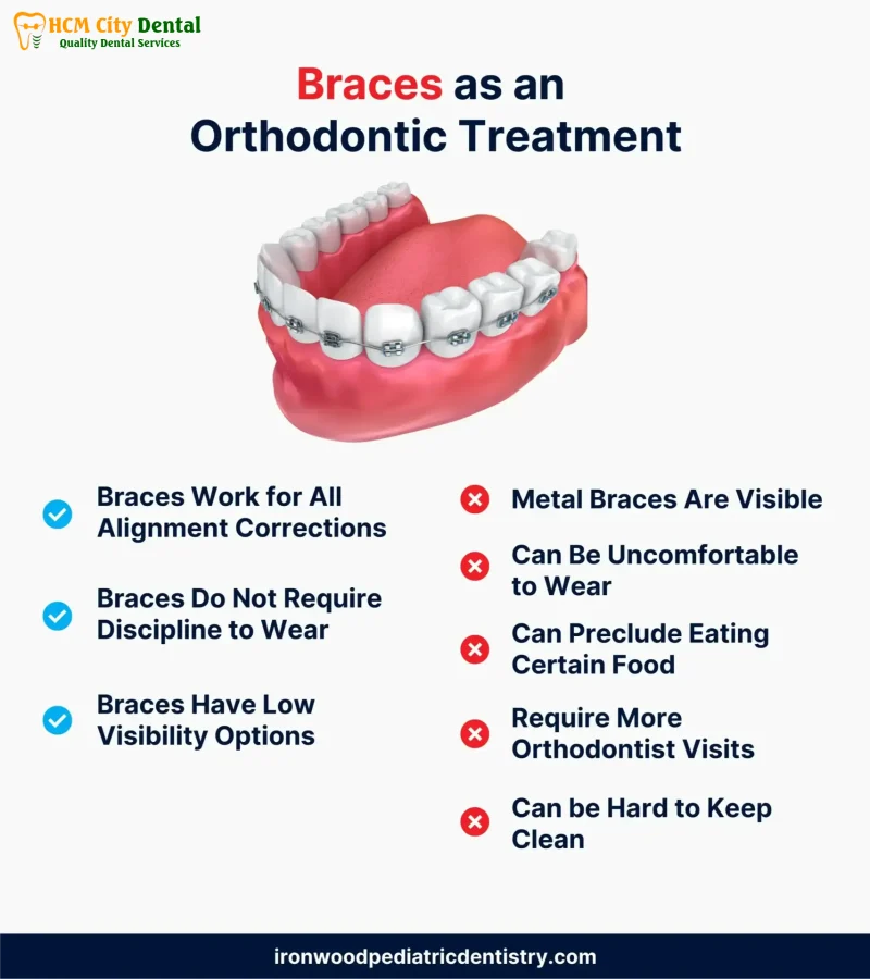 Nieng-rang-invisalign-co-hieu-qua-khong-5-bac-si-cuong-nha-khoa-bscuong-bac-si-cuong-nha-khoa-bscuong