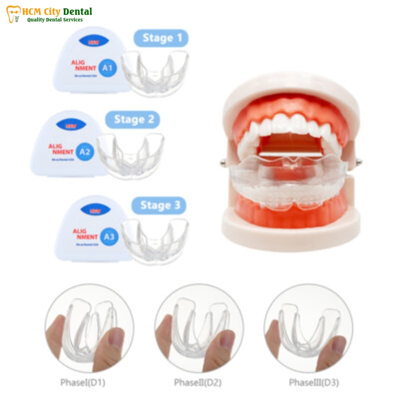 Nieng-rang-silicon-4-bac-si-cuong-nha-khoa-bscuong-bac-si-cuong-nha-khoa-bscuong