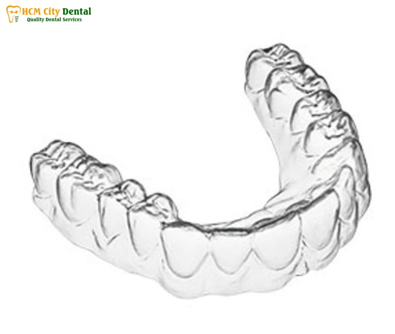 Nieng-rang-trong-suot-clear-aligner-2-bac-si-cuong-nha-khoa-bscuong-bac-si-cuong-nha-khoa-bscuong