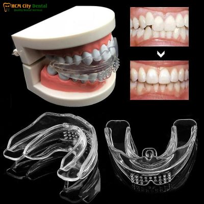 review-mieng-nieng-rang-silicon-1-bac-si-cuong-nha-khoa-bscuong