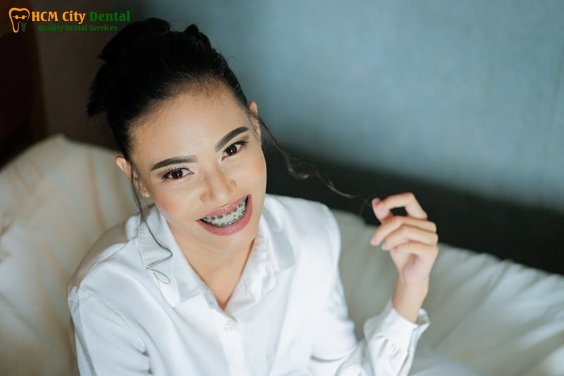 Nieng-rang-co-phai-phau-thuat-tham-my-khong-2-bac-si-cuong-nha-khoa-bscuong-bac-si-cuong-nha-khoa-bscuong